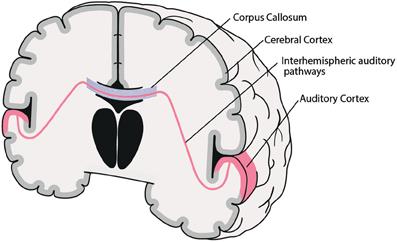 Interhemispheric auditory connectivity: structure and function related to auditory verbal hallucinations